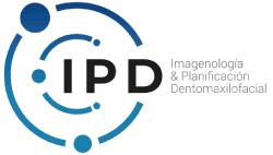 Ipd Perú